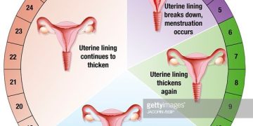 Why you should do family planning?