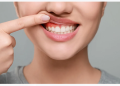 Bleeding gums mean for people with diabetes ?? know facts